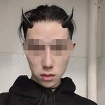 做完隆鼻失敗修復(fù)手術(shù)，再看自己儼然屬于超模中的一員了