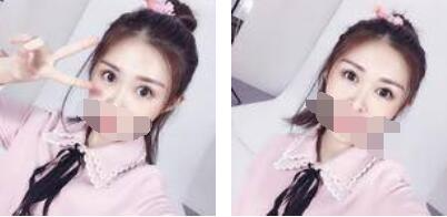 沒有了眼袋困擾，身體和心態(tài)都年輕了十歲