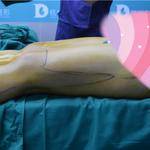 做完雙腿吸脂手術(shù)，穿上我的長(zhǎng)筒靴，盡顯女性魅力！