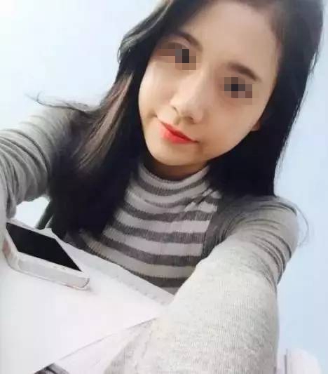 金奇龍膨體隆鼻案例展示