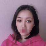 做完雙眼皮手術(shù)眼睛更加迷人了，眼睛自己會撩小哥哥