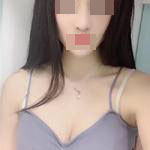 自體脂肪隆胸+隆鼻后形象瞬間提升，對(duì)生活更加自信了