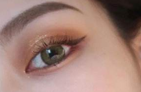 西安高一生醫(yī)療美容醫(yī)院激光去黑眼圈