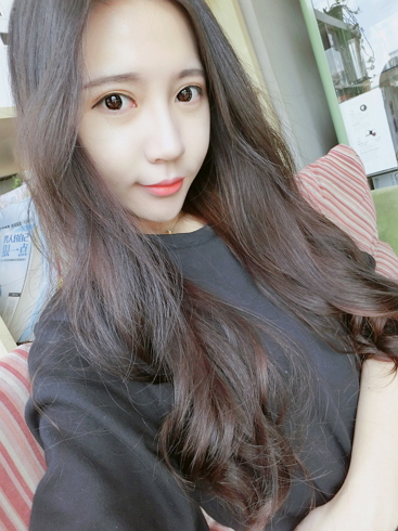  濟(jì)南安美醫(yī)療整形醫(yī)生李思思下頜角整形案例