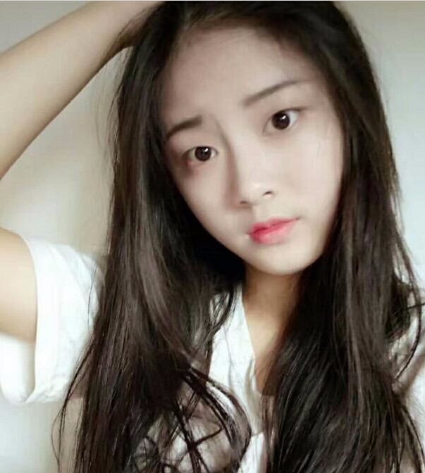 福州愛(ài)美爾整形黃林勝雙眼皮案例效果對(duì)比圖