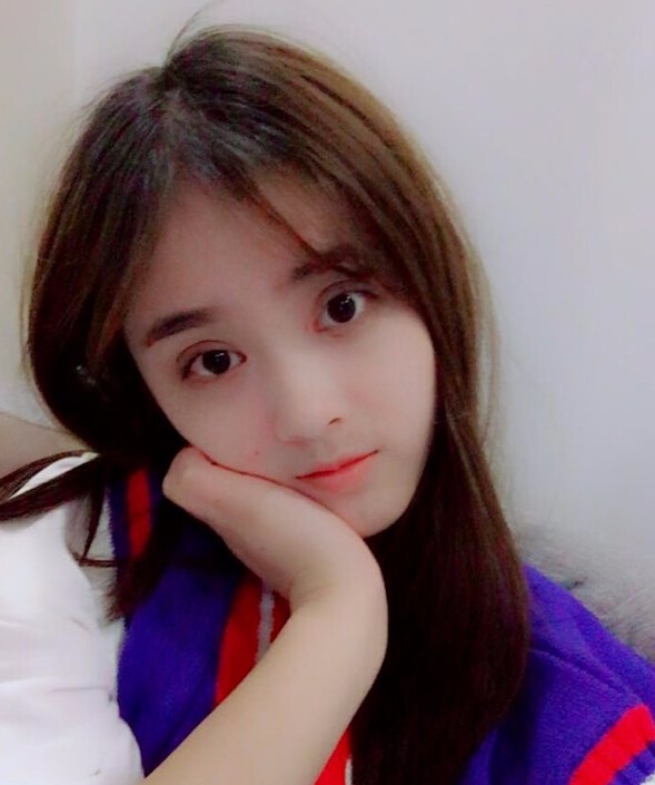 福州愛(ài)美爾整形黃林勝雙眼皮案例效果對(duì)比圖