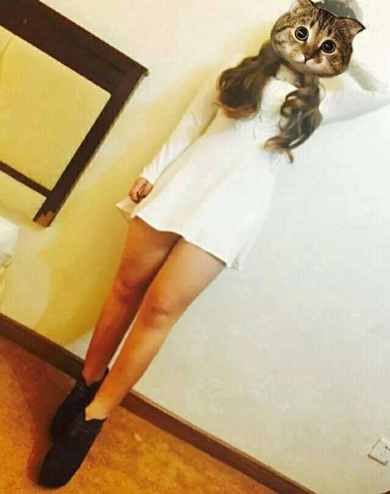 廣州軍頤醫(yī)院整形美容中心石建薇醫(yī)生腰腹吸脂真實案例對比圖