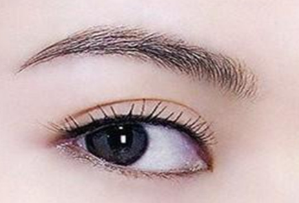 遵義醫(yī)學(xué)院附院雙眼皮修復(fù)