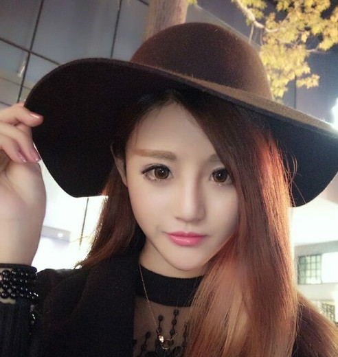 下頜角磨骨4個(gè)月后