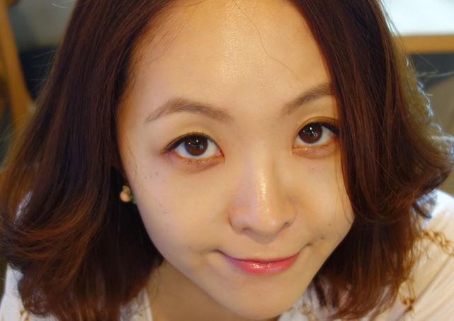 徐州時光洪揚醫(yī)療美容診所宮昔愿醫(yī)生做激光祛斑效果怎么樣？