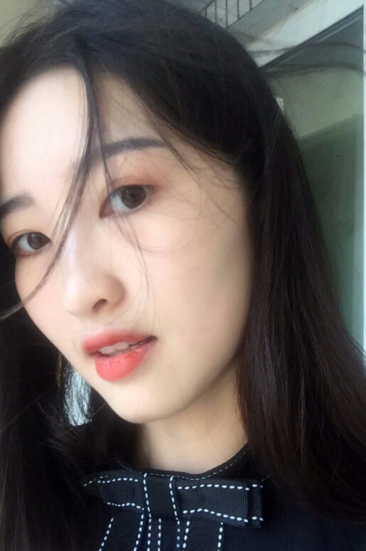 鄭州正合口腔門診部做牙齒矯正怎么樣？附郭毅醫(yī)生牙齒金屬托槽矯正案例