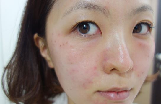 徐州時光洪揚醫(yī)療美容診所宮昔愿醫(yī)生做激光祛斑效果怎么樣？