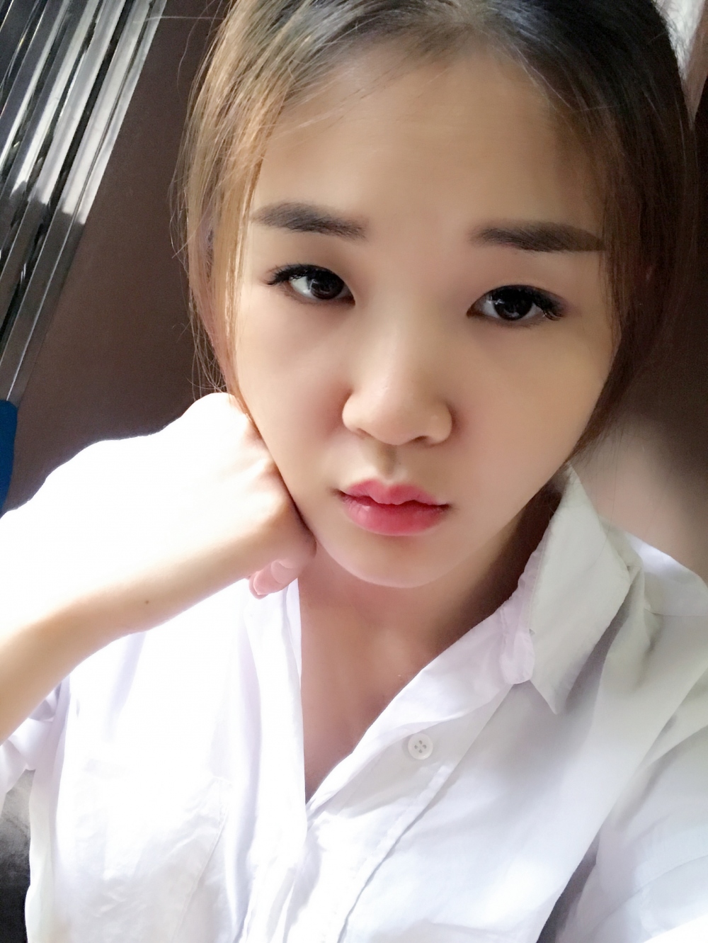 鄭州華領(lǐng)醫(yī)療美容醫(yī)院賀小虎醫(yī)生做眼綜合+鼻部整形手術(shù)效果怎么樣？