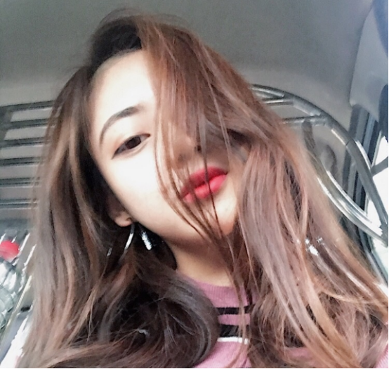 珠海平安康復(fù)醫(yī)院整形美容中心查元坤醫(yī)生面部吸脂案例效果對比圖