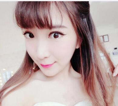 武漢中翰整形外科醫(yī)院陳志鵬醫(yī)生做雙眼皮修復效果怎么樣？附雙眼皮修復案例