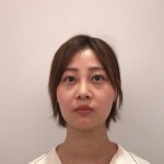 天津歐華威莎整形醫(yī)生姚玲做面部埋線提升效果怎么樣？附埋線提升案例