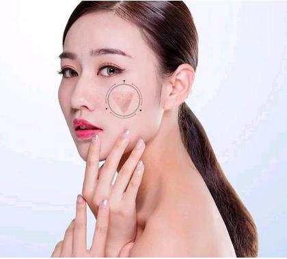 ?？诩t妝尚整形光子嫩膚