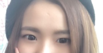 長春麥西美嘉整形醫(yī)生王圣博做雙眼皮手術(shù)效果怎么樣？附雙眼皮案例