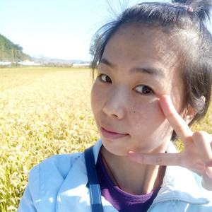 珠海蒂伊醫(yī)療整形醫(yī)生廖俊凱做激光祛斑效果怎么樣？附激光祛斑案例效果圖