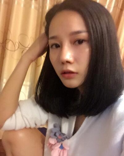 西安陽(yáng)光整形醫(yī)院邵萍醫(yī)生做鼻綜合整形怎么樣？附鼻綜合整形案例