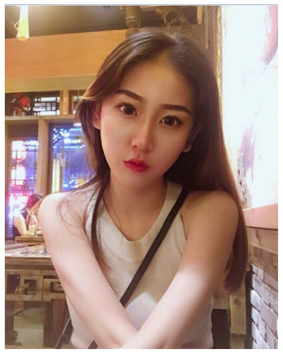 珠海海大整形美容外科黃發(fā)醫(yī)生做面部吸脂怎么樣？附面部吸脂案例