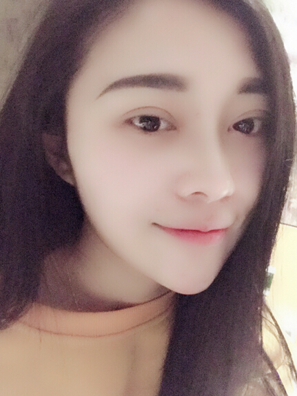 石家莊雅芳亞整形醫(yī)生王文明做雙眼皮+開(kāi)眼角+鼻綜合整形案例效果對(duì)比圖