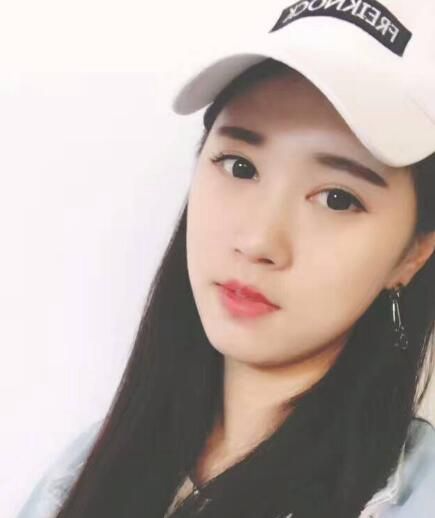 北京亞奧整形醫(yī)生程金龍做韓式三點(diǎn)雙眼皮+開內(nèi)眼角效果怎么樣？