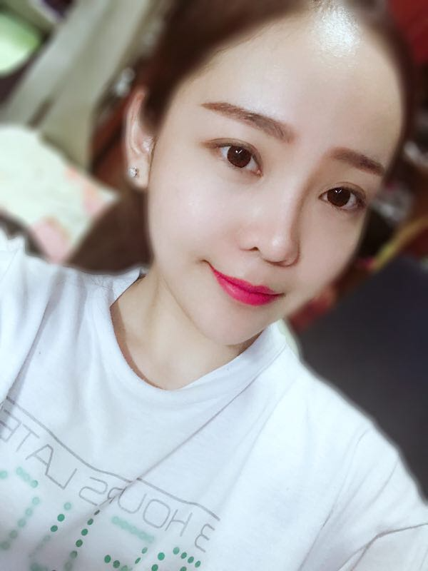 北京可思美醫(yī)療整形醫(yī)生蘇靜做臉部自體脂肪填充效果怎么樣？