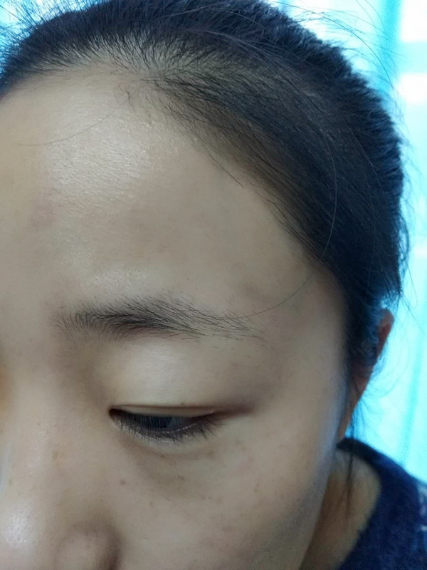 長沙愛思特醫(yī)療美容醫(yī)院做半永久紋眉怎么樣？附彭子娟醫(yī)生案例效果圖