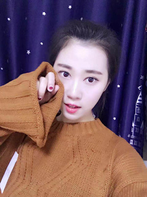 北京貴美匯整形醫(yī)院上田寬醫(yī)生做雙眼皮案例效果對(duì)比圖