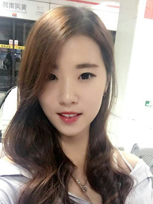 北京貴美匯整形醫(yī)院上田寬醫(yī)生做雙眼皮案例效果對(duì)比圖