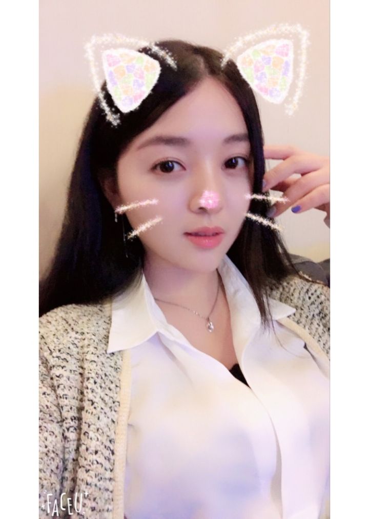 北京京韓整形醫(yī)生王義山做埋線雙眼皮怎么樣？附案例效果對比圖