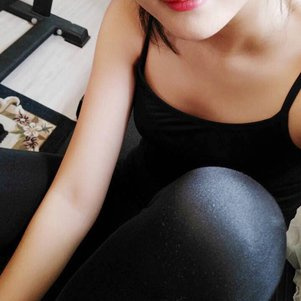 岳陽(yáng)愛思特醫(yī)療美容醫(yī)院醫(yī)生王福生做手臂吸脂怎么樣？附案例效果圖