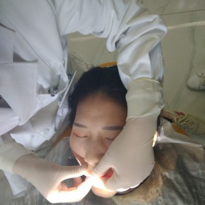 洛陽(yáng)友好口腔醫(yī)院醫(yī)生李新然做牙貼面怎么樣？附案例效果圖