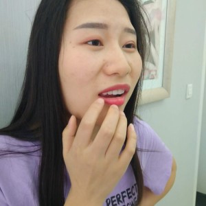 洛陽(yáng)友好口腔醫(yī)院醫(yī)生李新然做牙貼面怎么樣？附案例效果圖