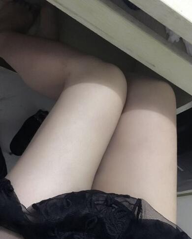 上海保加醫(yī)療美容門診部做大腿吸脂怎么樣？附楊勇醫(yī)生案例效果對比圖