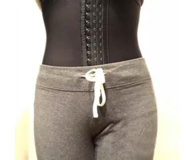 廣州尚美善造美容醫(yī)院醫(yī)生邵方做水動(dòng)力吸脂怎么樣？附案例效果圖