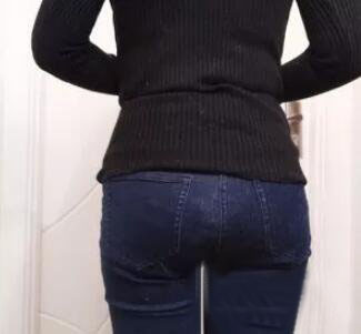 廣州尚美善造美容醫(yī)院醫(yī)生邵方做水動(dòng)力吸脂怎么樣？附案例效果圖