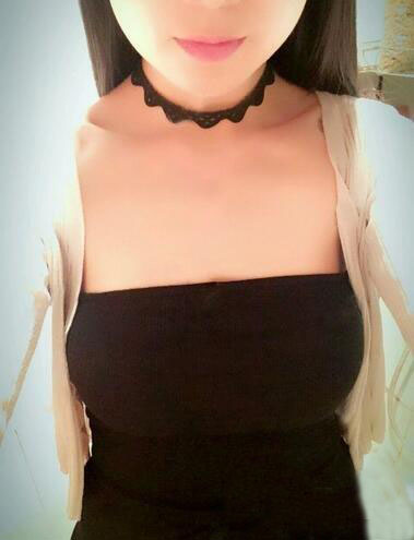 海南伊佳醫(yī)療美容醫(yī)院醫(yī)生涂陽君做假體隆胸怎么樣？附案例效果對比圖