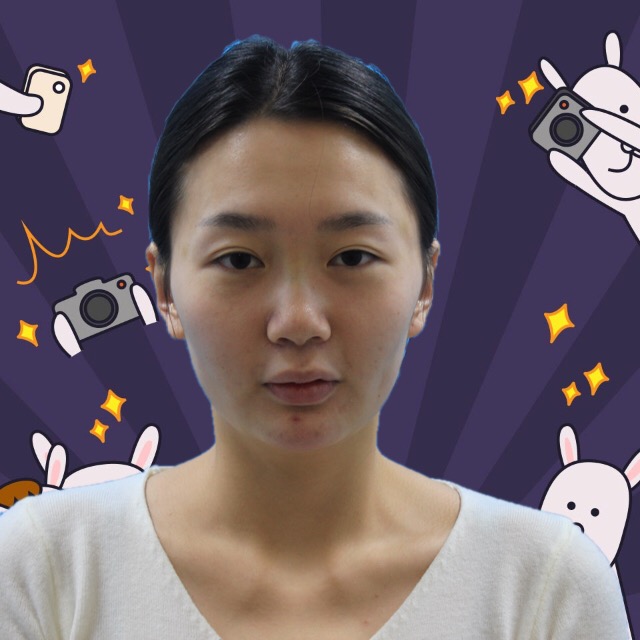 杭州格萊美整形美容醫(yī)院醫(yī)生張霞飛做自體脂肪全臉填充效果怎么樣？