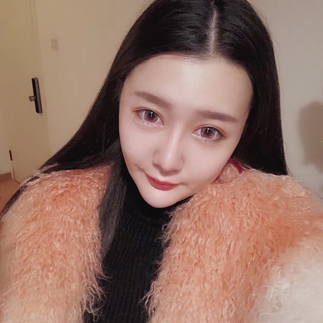 杭州格萊美整形美容醫(yī)院醫(yī)生張霞飛做自體脂肪全臉填充效果怎么樣？