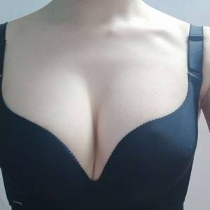 長沙亞韓醫(yī)學(xué)美容醫(yī)院醫(yī)生鄭京湘做假體隆胸怎么樣？附醫(yī)生案例效果對比圖