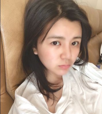 上海時光整形外科醫(yī)院醫(yī)生何晉龍做假體隆胸怎么樣？附案例效果對比圖