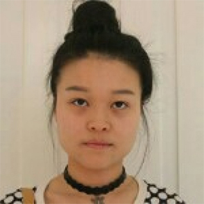 鄭州管城中醫(yī)院整形美容中心醫(yī)生張秀英做注射瘦臉怎么樣？附除皺瘦臉案例效果圖