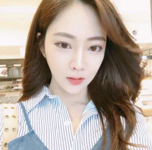 廣州中科美整形醫(yī)院醫(yī)生鄭志敏做鼻部多項(xiàng)綜合整形怎么樣？附案例效果圖