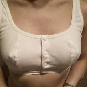 長沙亞韓醫(yī)學(xué)美容醫(yī)院醫(yī)生鄭京湘做假體隆胸怎么樣？附醫(yī)生案例效果對比圖