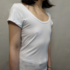 長沙亞韓醫(yī)學(xué)美容醫(yī)院醫(yī)生鄭京湘做假體隆胸怎么樣？附醫(yī)生案例效果對比圖