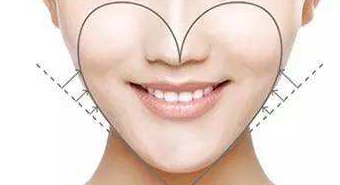 寧波珈禾整形專科醫(yī)院假體墊下巴