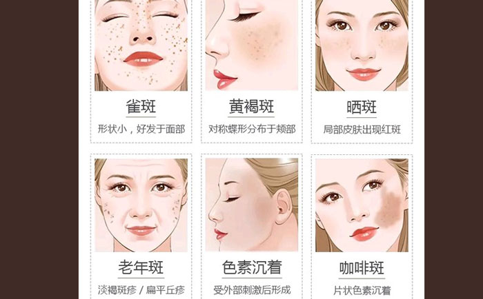 醫(yī)院激光祛斑貴不貴？正規(guī)醫(yī)院激光祛斑多少錢？