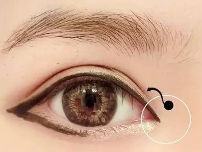 上海華美醫(yī)療美容醫(yī)院開(kāi)眼角